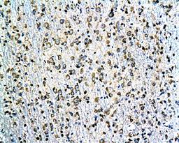 IHC-P of rat hippocampal tissue(Tau antibody at 1:200) 