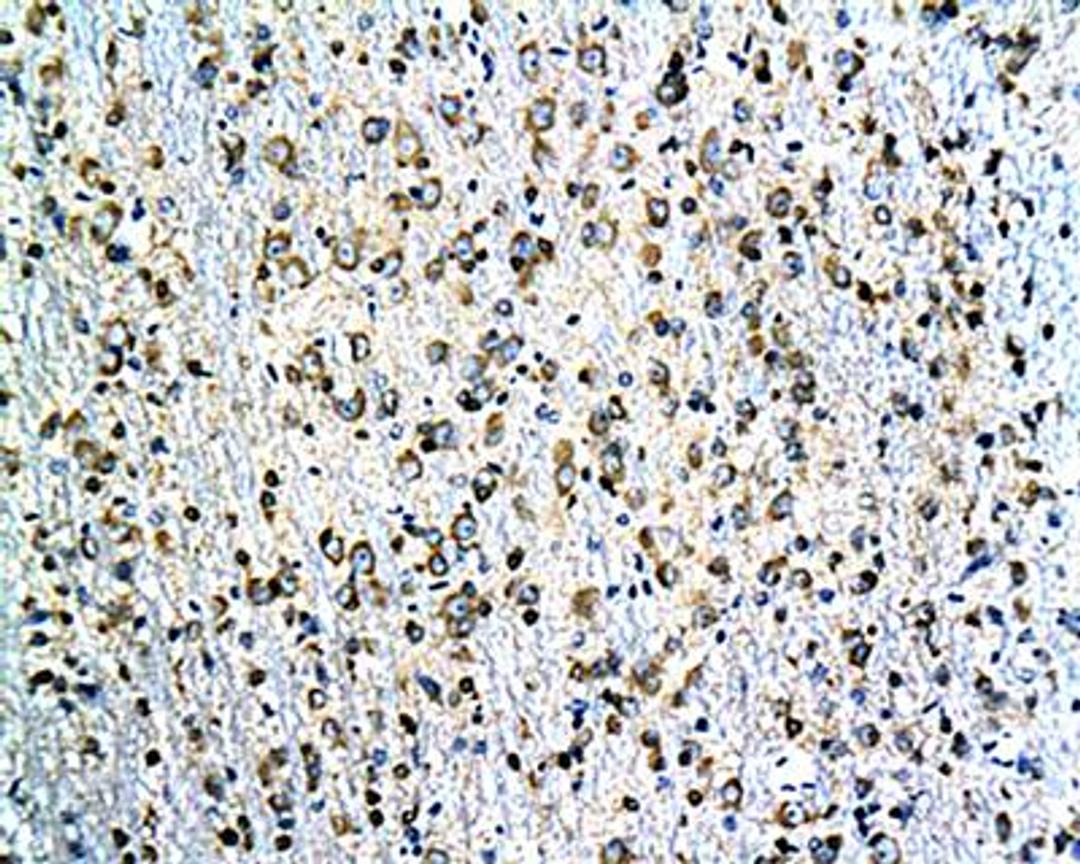 IHC-P of rat hippocampal tissue(Tau antibody at 1:200)