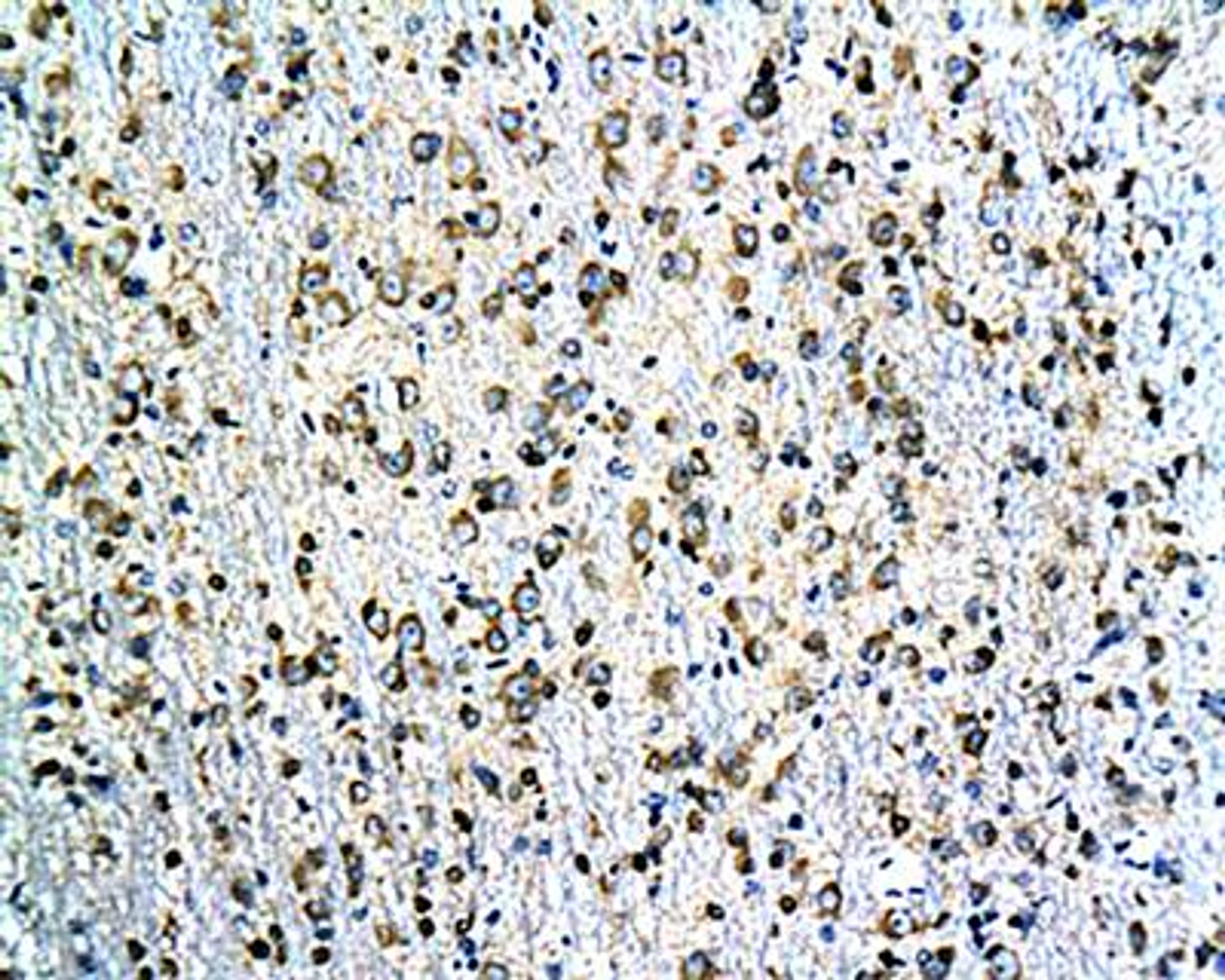 IHC-P of rat hippocampal tissue(Tau antibody at 1:200)