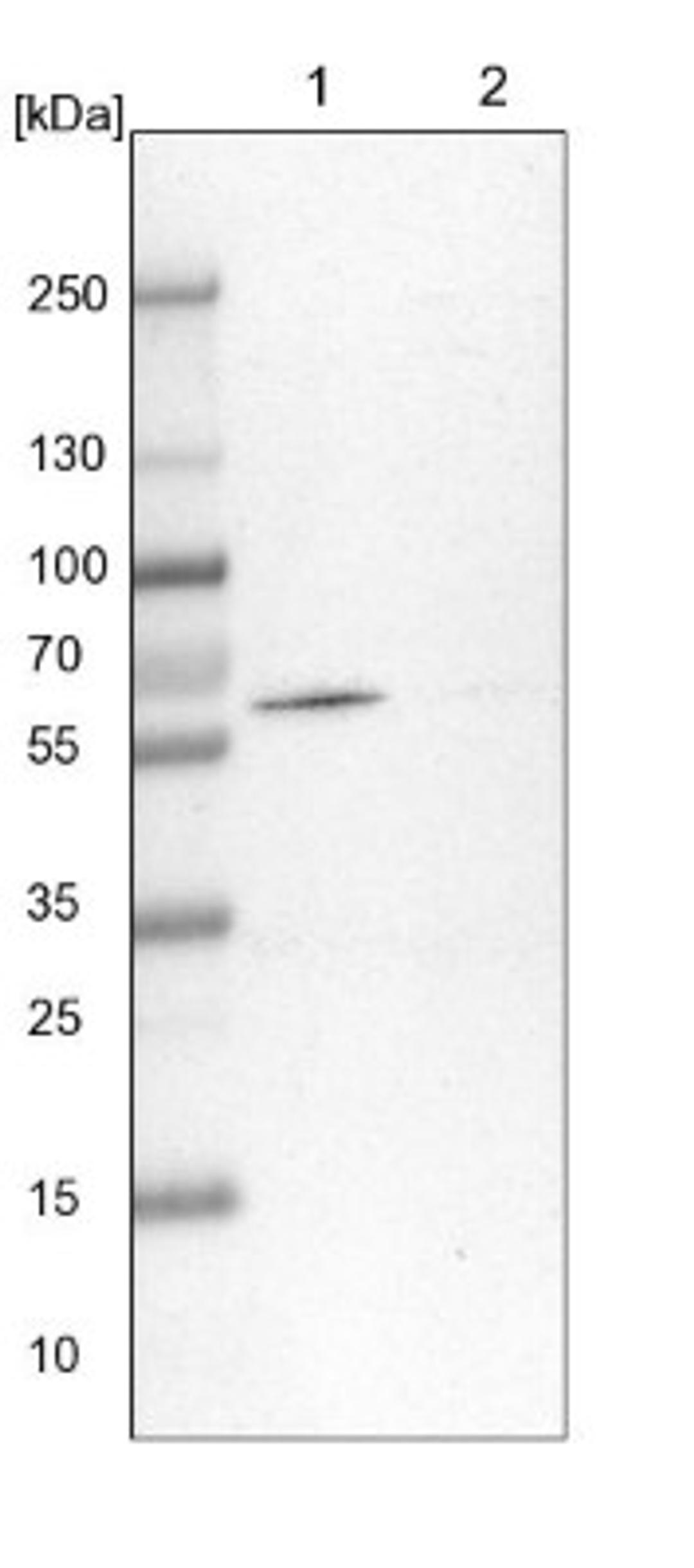 Western Blot: CPNE3 Antibody [NBP1-85939] - Lane 1: NIH-3T3 cell lysate (Mouse embryonic fibroblast cells)<br/>Lane 2: NBT-II cell lysate (Rat Wistar bladder tumour cells)