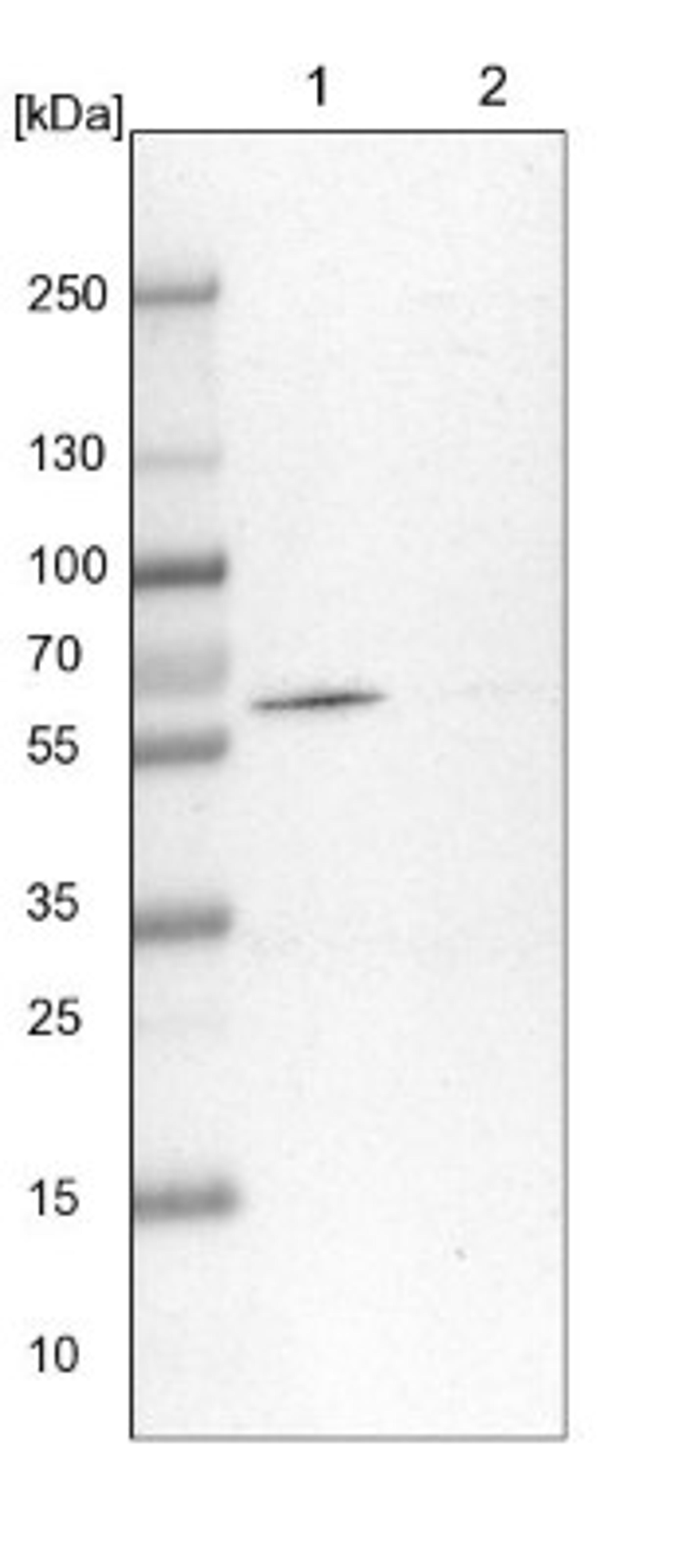 Western Blot: CPNE3 Antibody [NBP1-85939] - Lane 1: NIH-3T3 cell lysate (Mouse embryonic fibroblast cells)<br/>Lane 2: NBT-II cell lysate (Rat Wistar bladder tumour cells)