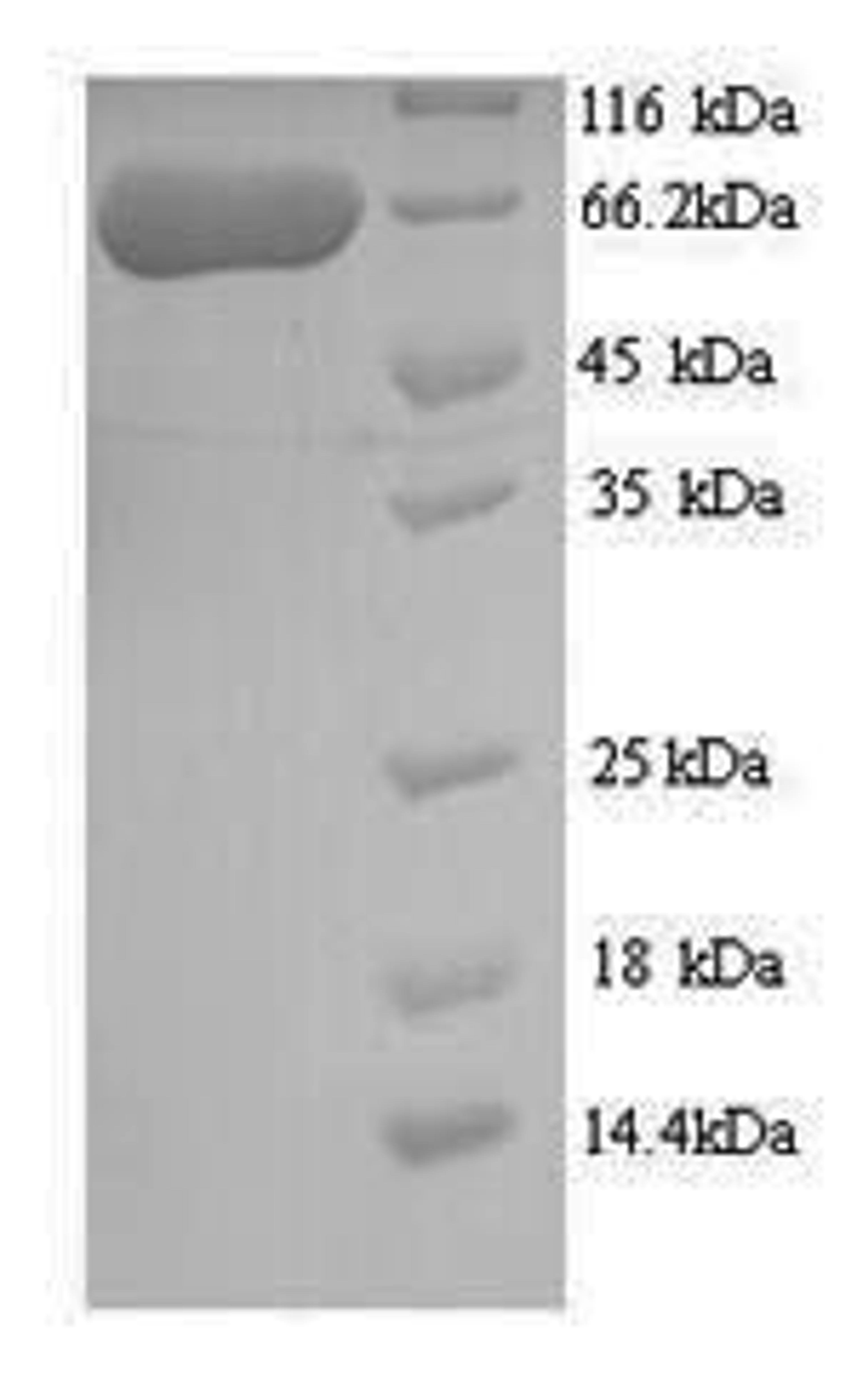 (Tris-Glycine gel) Discontinuous SDS-PAGE (reduced) with 5% enrichment gel and 15% separation gel.