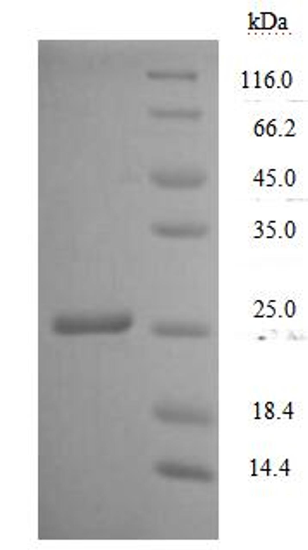 (Tris-Glycine gel) Discontinuous SDS-PAGE (reduced) with 5% enrichment gel and 15% separation gel.