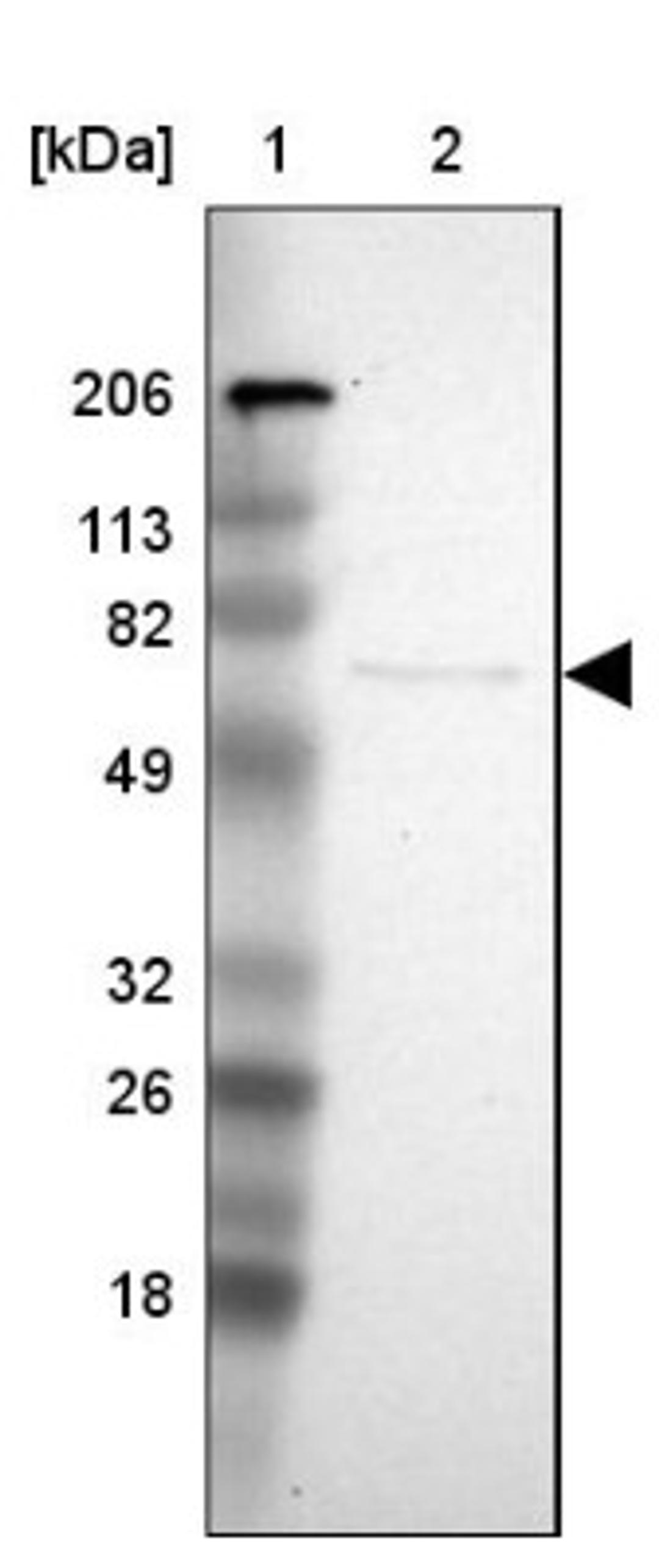 Western Blot: PLZF Antibody [NBP1-80894] - Lane 1: Marker [kDa] 206, 113, 82, 49, 32, 26, 18<br/>Lane 2: Human cell line RT-4