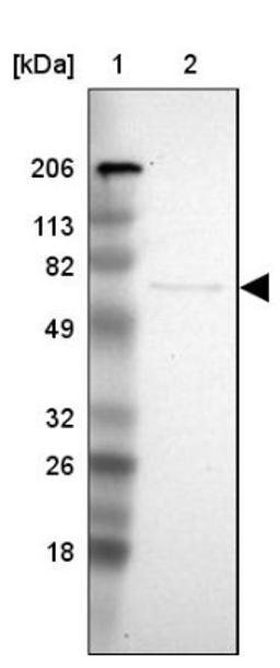 Western Blot: PLZF Antibody [NBP1-80894] - Lane 1: Marker [kDa] 206, 113, 82, 49, 32, 26, 18<br/>Lane 2: Human cell line RT-4