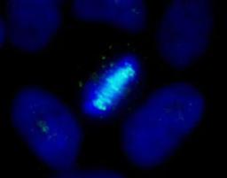 Detection of human CENP-B by immunocytochemistry.