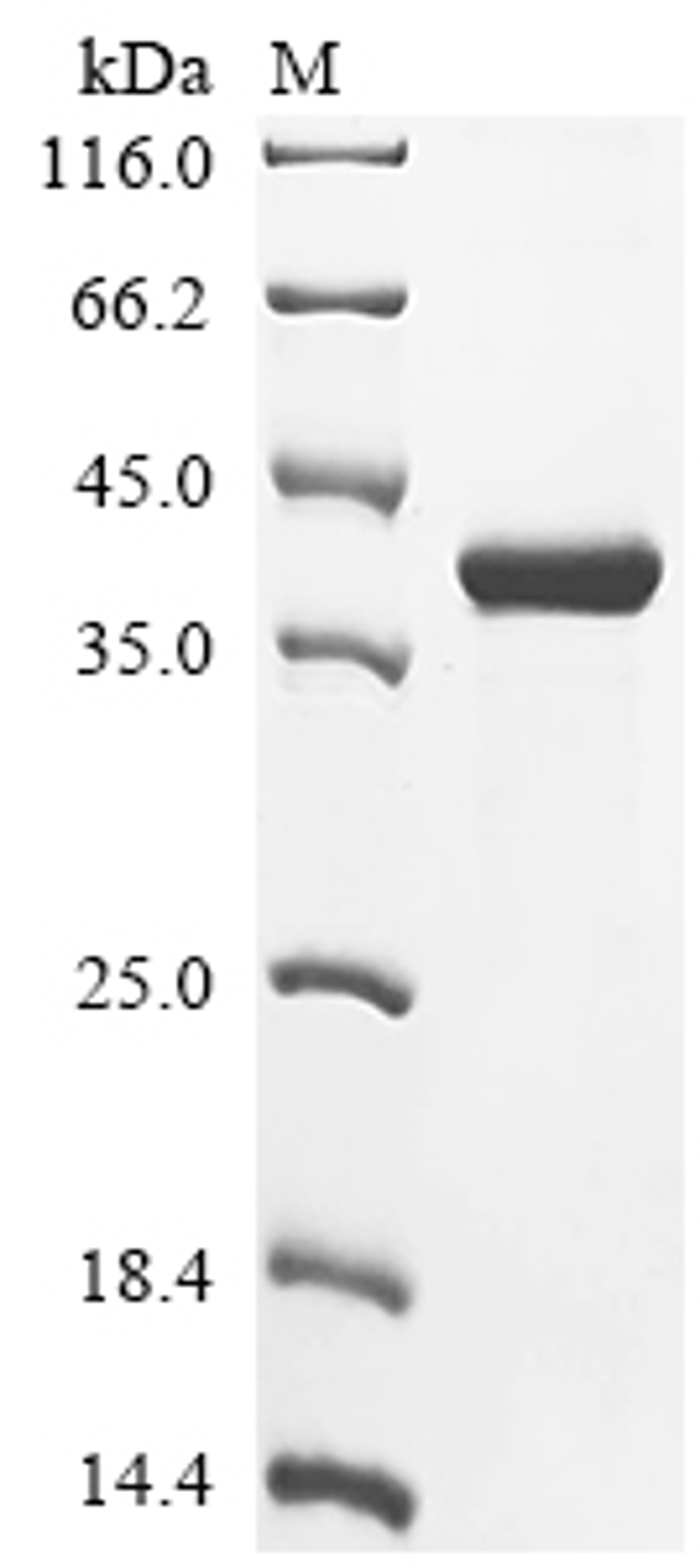 (Tris-Glycine gel) Discontinuous SDS-PAGE (reduced) with 5% enrichment gel and 15% separation gel.