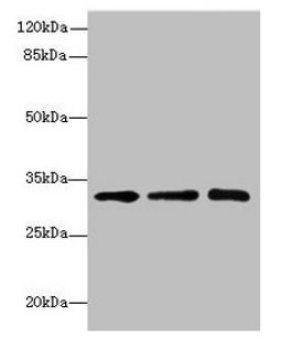 Western blot. All lanes: RRAS2 antibody at 4.55µg/ml. Lane 1: Mouse kidney tissue. Lane 2: Mouse liver tissue. Lane 3: Jurkat whole cell lysate. Secondary. Goat polyclonal to rabbit IgG at 1/10000 dilution. Predicted band size: 33, 29 kDa. Observed band size: 33 kDa