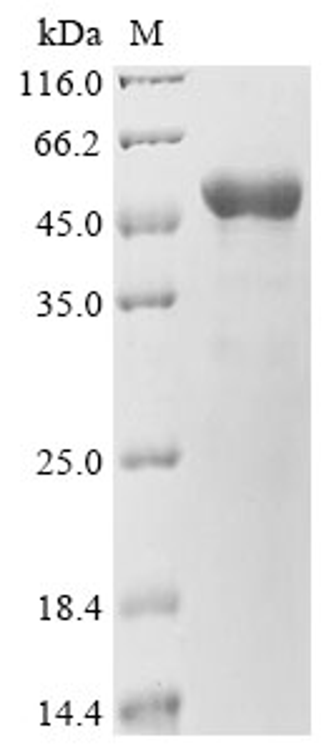 (Tris-Glycine gel) Discontinuous SDS-PAGE (reduced) with 5% enrichment gel and 15% separation gel.