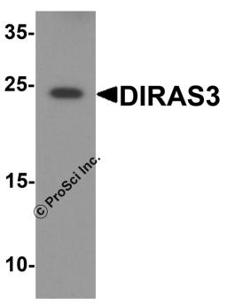 Western blot analysis of DIRAS3 in human testis tissue lysate with DIRAS3 antibody at 1 &#956;g/ml.