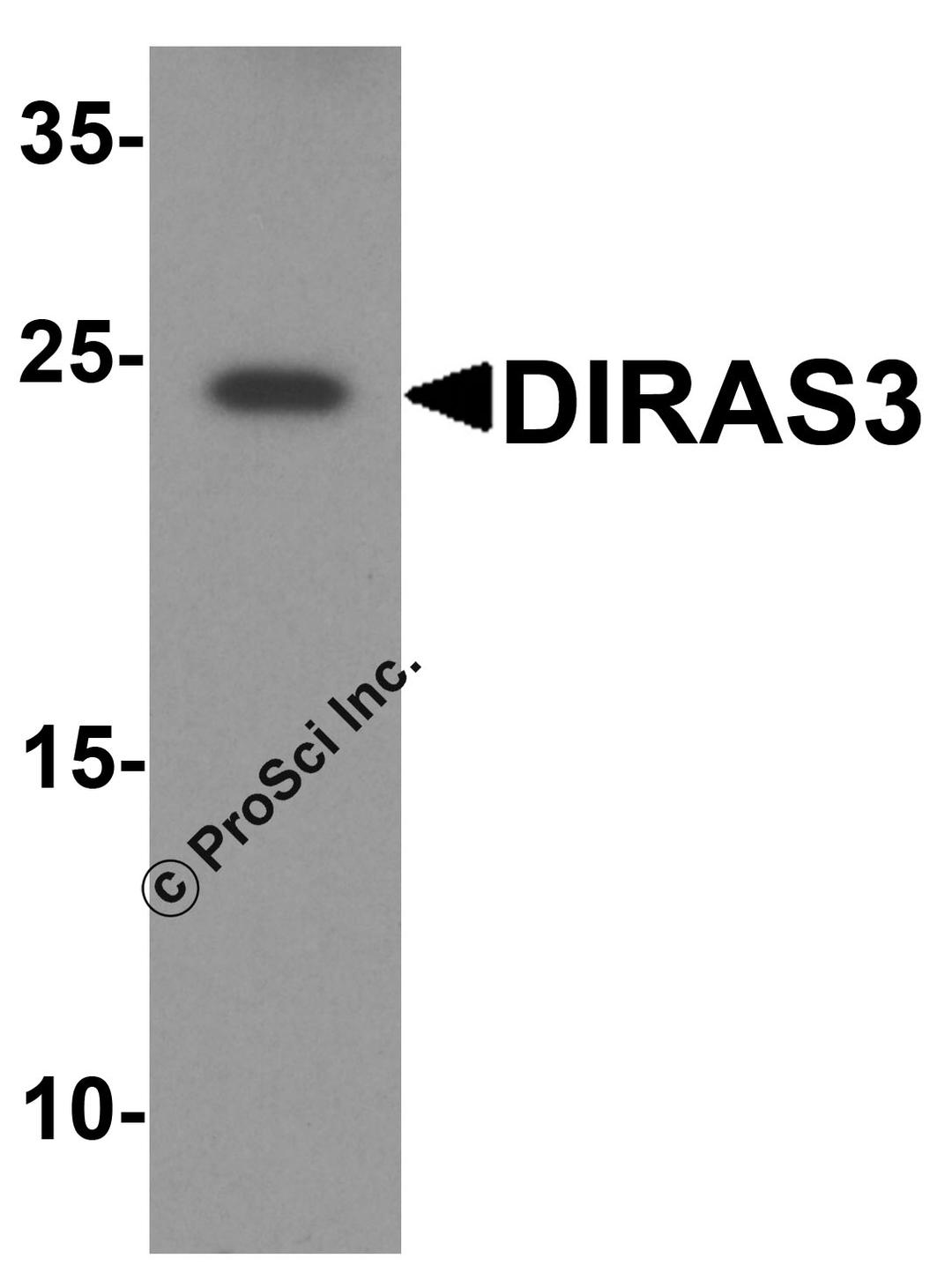 Western blot analysis of DIRAS3 in human testis tissue lysate with DIRAS3 antibody at 1 μg/ml.
