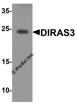 Western blot analysis of DIRAS3 in human testis tissue lysate with DIRAS3 antibody at 1 μg/ml.