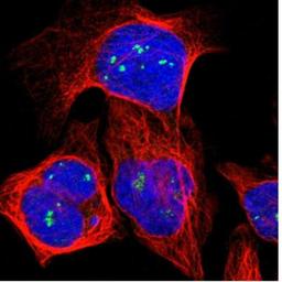 Immunocytochemistry/Immunofluorescence: FMR1NB Antibody [NBP1-85403] - Staining of human cell line U-2 OS shows positivity in nucleoli. Antibody staining is shown in green.