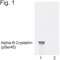 Western Blot: AlphaB Crystallin/CRYAB [p Ser45] Antibody [NB120-5598] - Analysis of recombinant bovine phospho-alpha-B crystallin (Ser45). Lane 1 is phospho-alpha-B crystallin (Ser45) and lane 2 is unphosphorylated alpha-B crystallin.