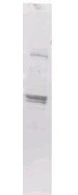 Western blot analysis of recombinant protein using MBP Epitope Tag antibody