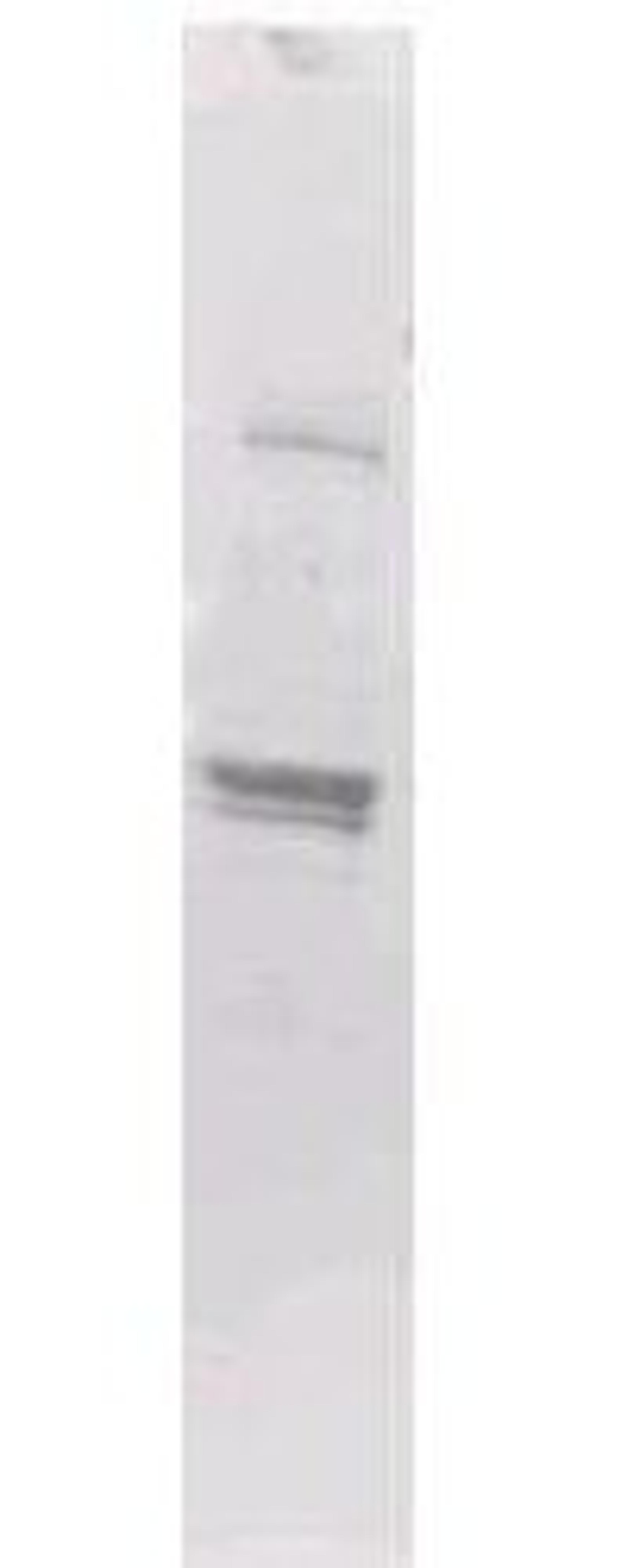 Western blot analysis of recombinant protein using MBP Epitope Tag antibody