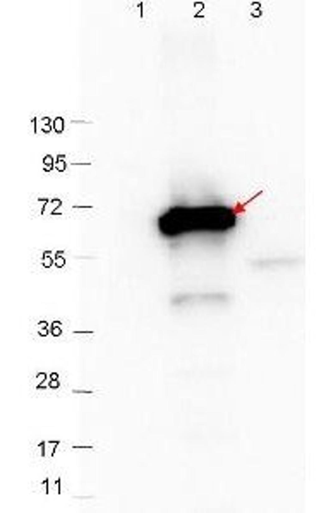 Western blot analysis of recombinant CRASP-2 protein and Molecular weight markers using CRASP-2 antibody