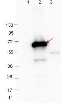 Western blot analysis of recombinant CRASP-2 protein and Molecular weight markers using CRASP-2 antibody