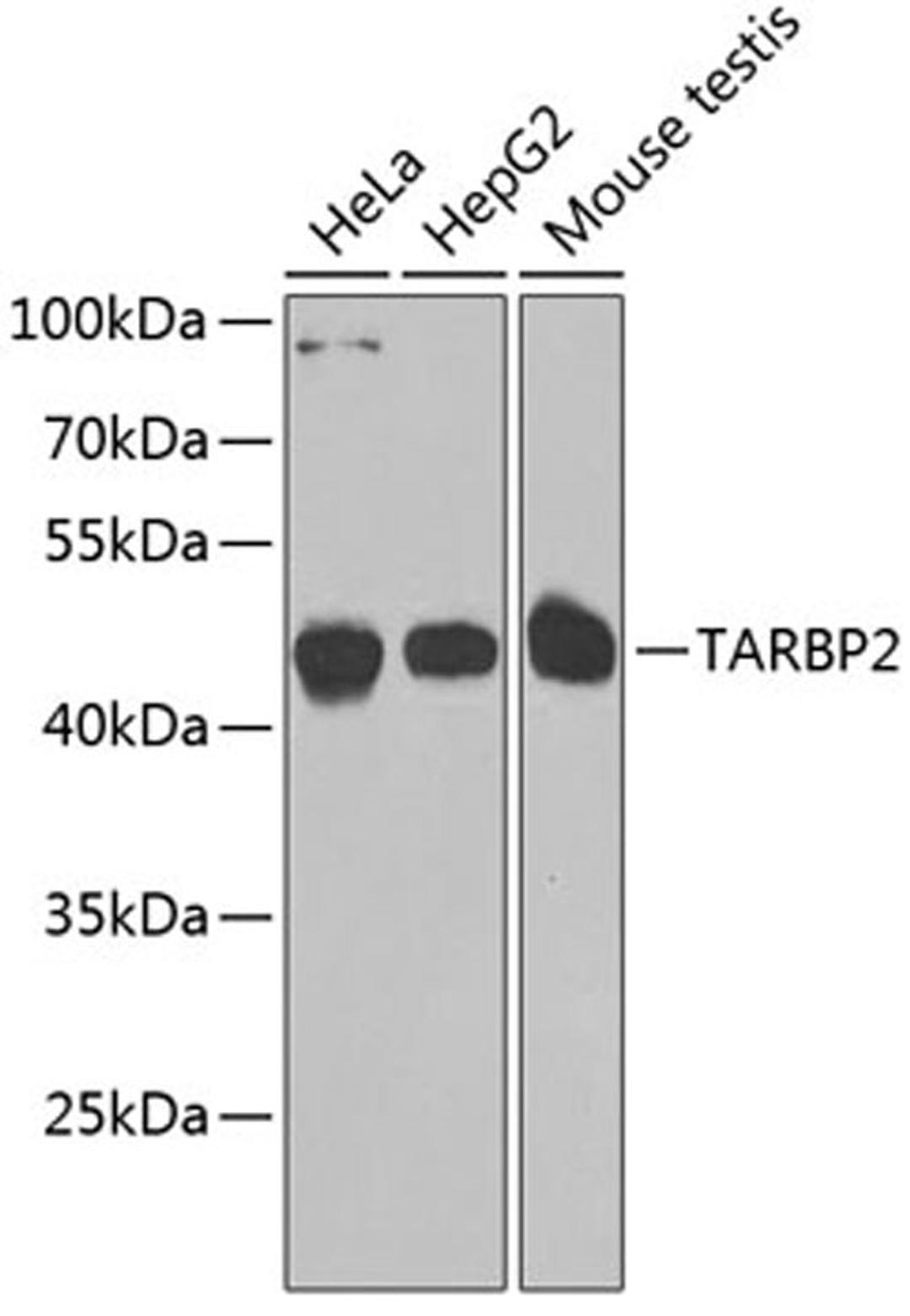 Western blot - TARBP2 antibody (A7533)