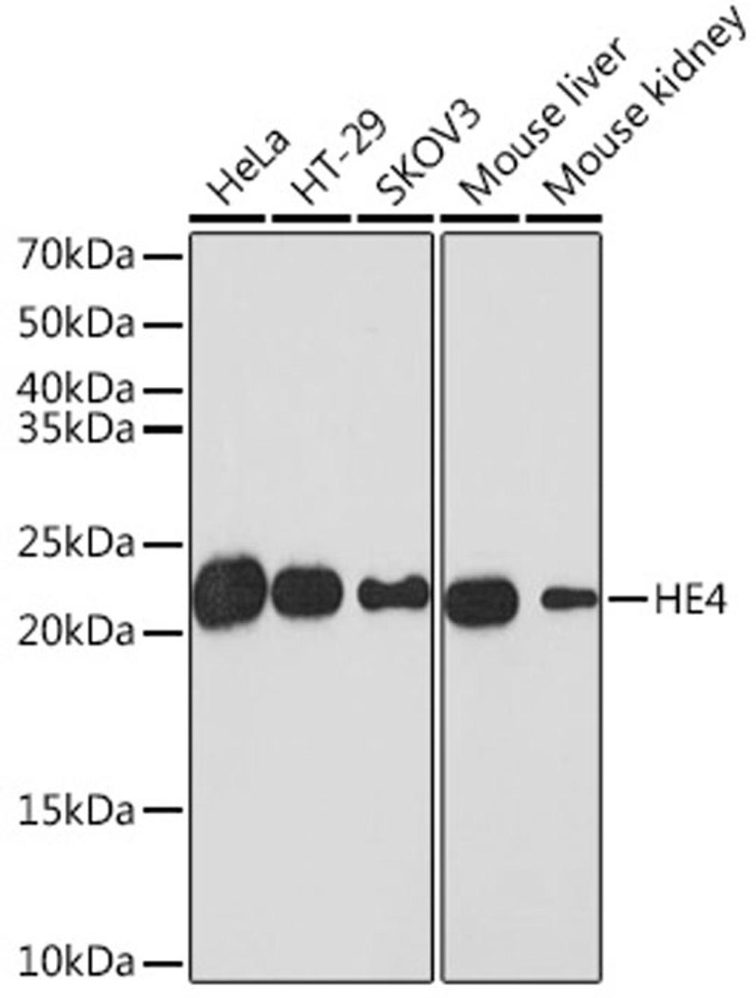 Western blot - HE4 Rabbit mAb (A3276)