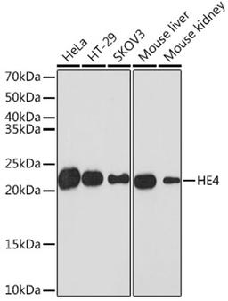 Western blot - HE4 Rabbit mAb (A3276)