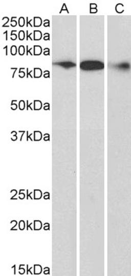 45-530 (0.3ug/ml) staining of Human Frontal Cortex (A), Mouse (B) and Rat (C) Brain lysate (35ug protein in RIPA buffer). Primary incubation was 1 hour. Detected by chemiluminescence.