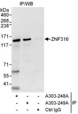 Detection of human ZNF316 by western blot of immunoprecipitates.