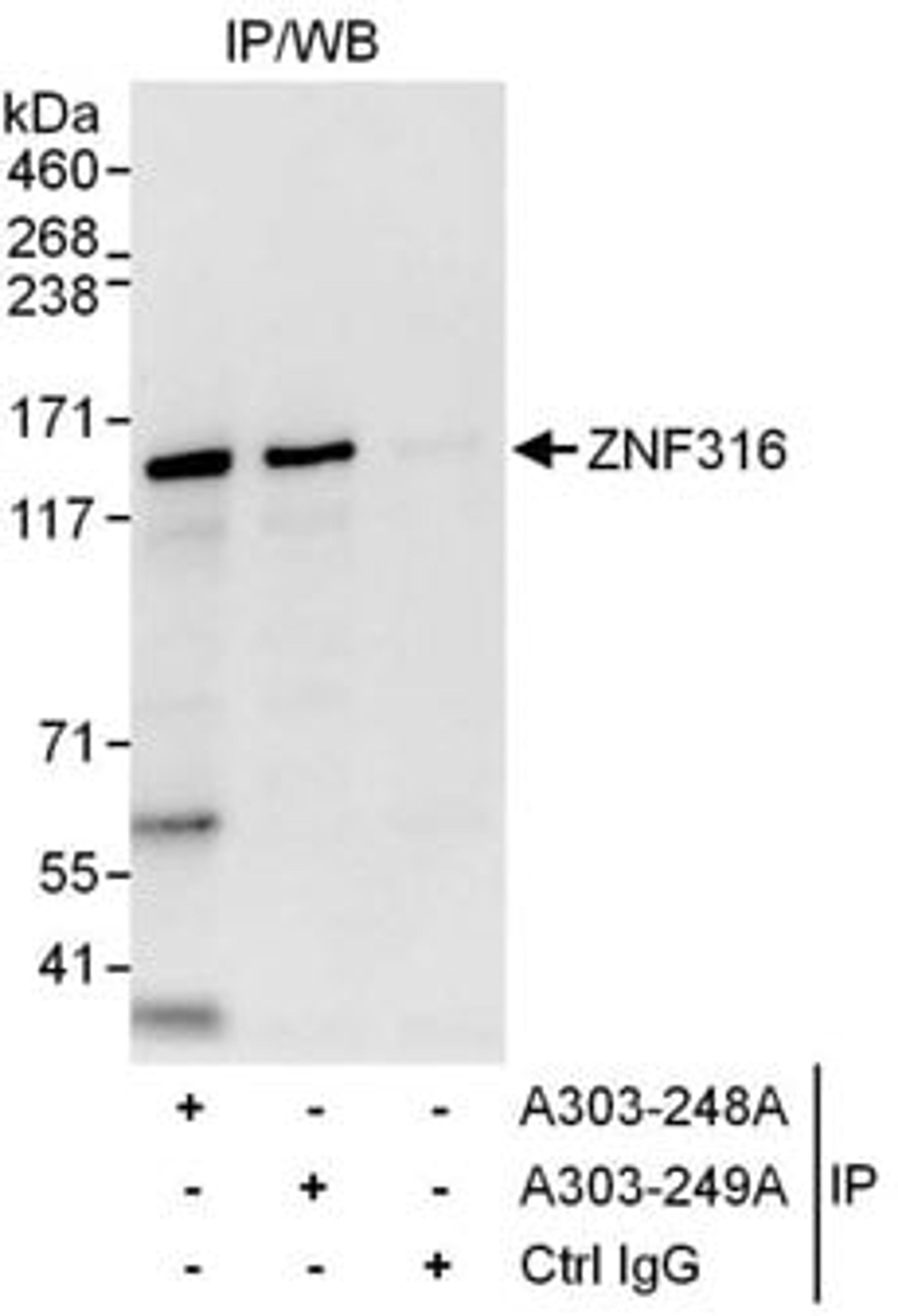 Detection of human ZNF316 by western blot of immunoprecipitates.