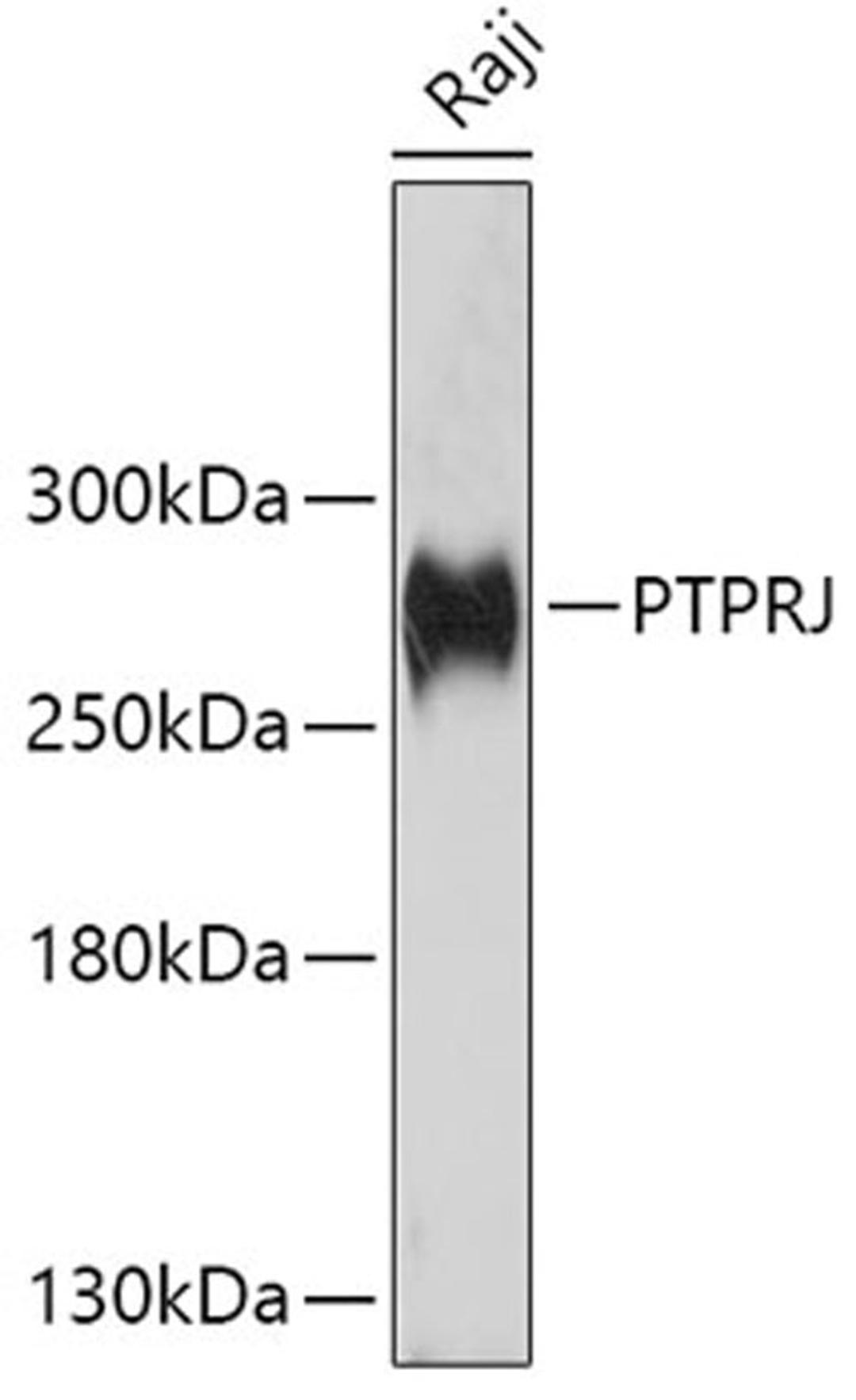 Western blot - PTPRJ antibody (A10169)