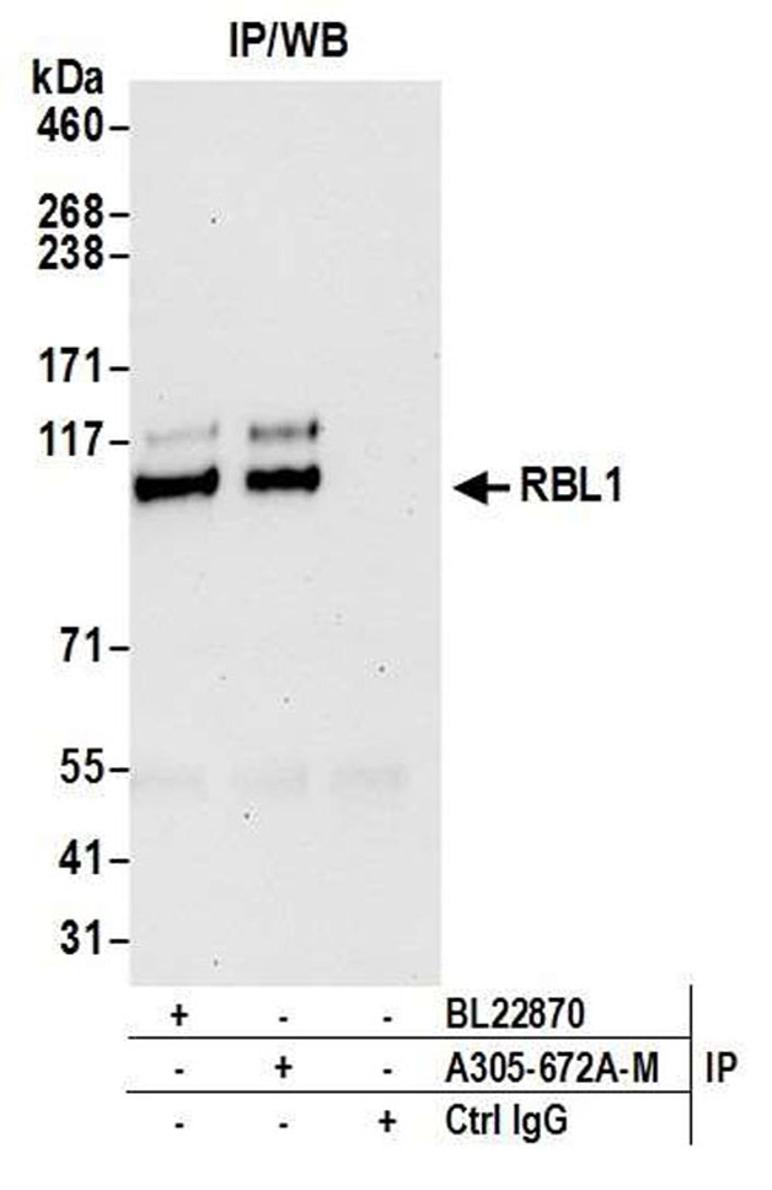 Detection of human RBL1 by WB of IP.