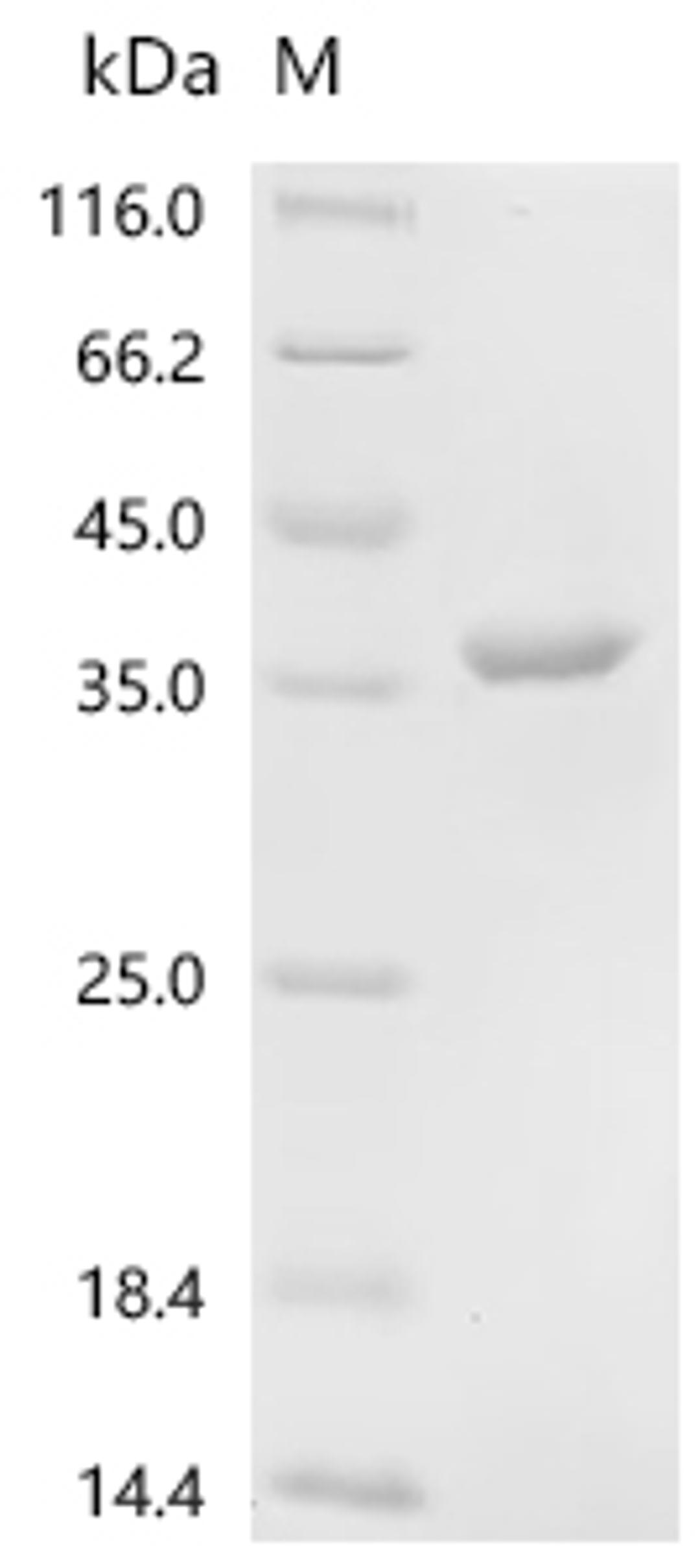 (Tris-Glycine gel) Discontinuous SDS-PAGE (reduced) with 5% enrichment gel and 15% separation gel.