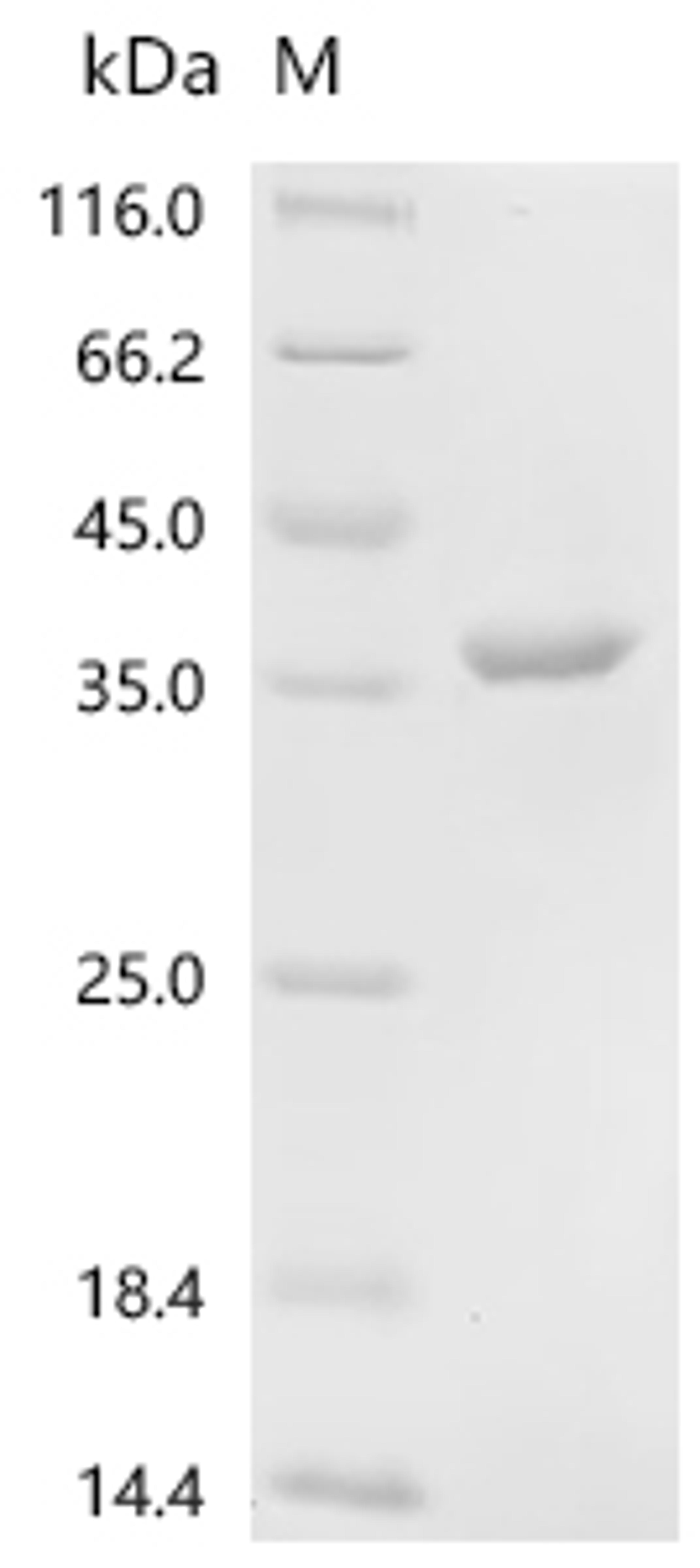 (Tris-Glycine gel) Discontinuous SDS-PAGE (reduced) with 5% enrichment gel and 15% separation gel.