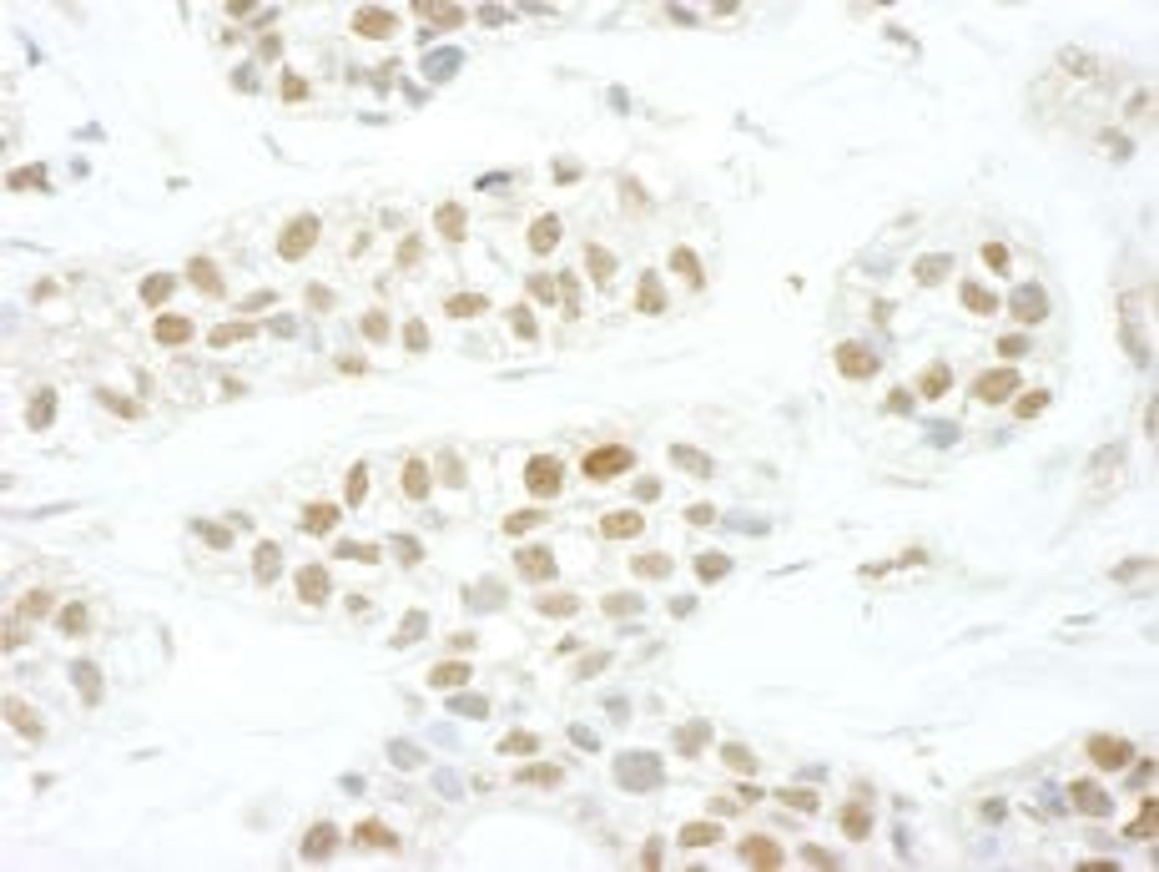 Detection of human TFIIS by immunohistochemistry.