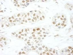 Detection of human TFIIS by immunohistochemistry.