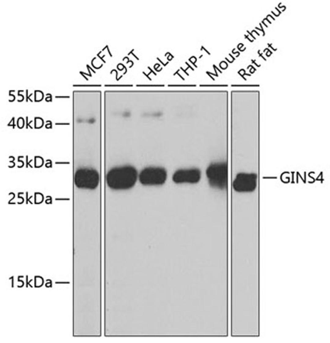 Western blot - GINS4 antibody (A8592)