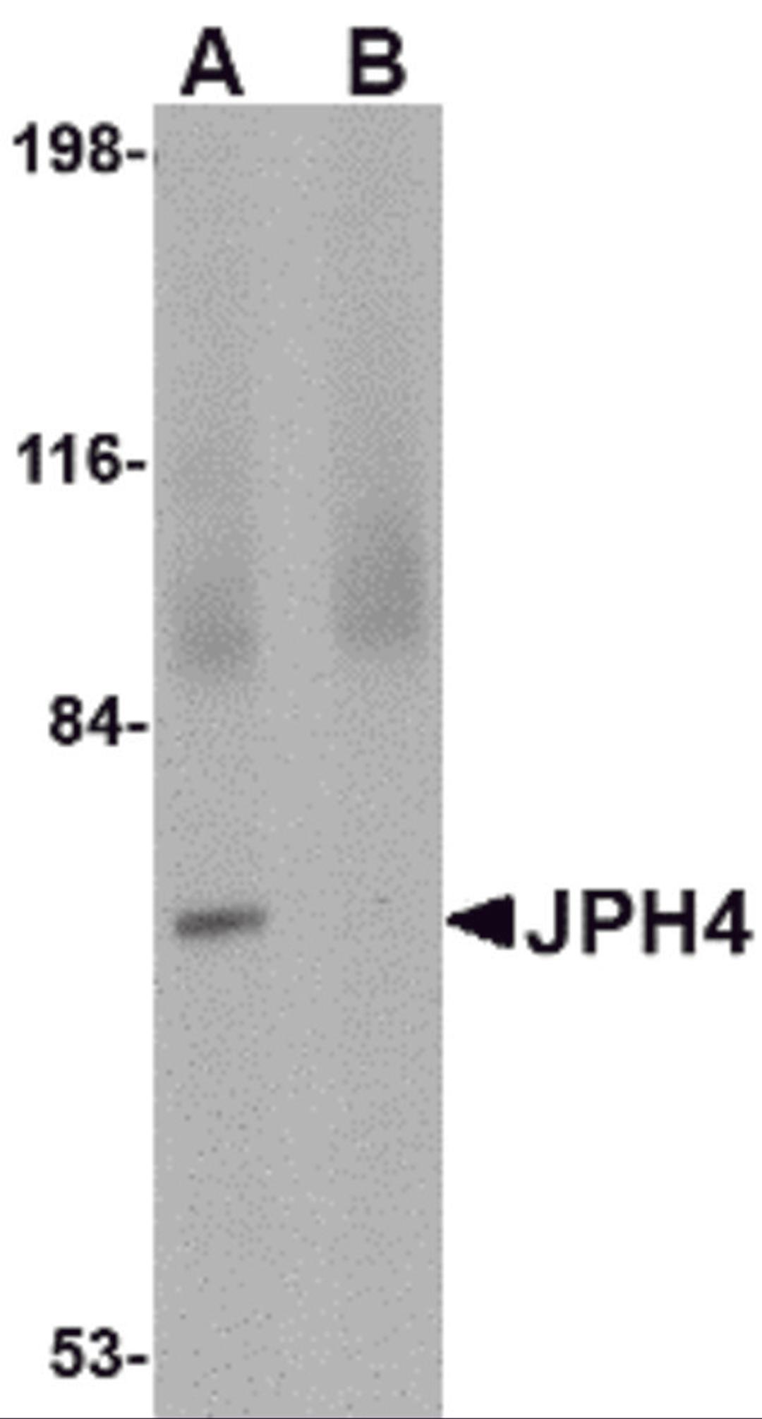 Western blot analysis of JPH4 in 293 cell lysate with JPH4 antibody at 1 &#956;g/mL in (A) the absence and (B) the presence of blocking peptide.