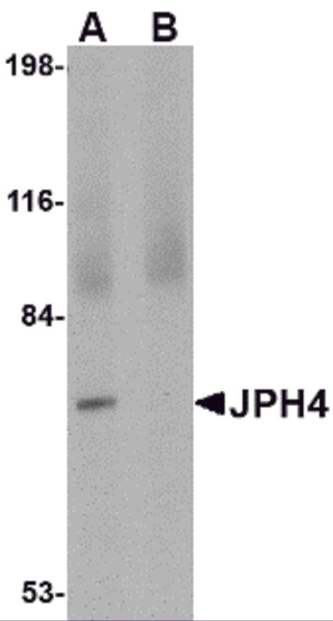 Western blot analysis of JPH4 in 293 cell lysate with JPH4 antibody at 1 μg/mL in (A) the absence and (B) the presence of blocking peptide.