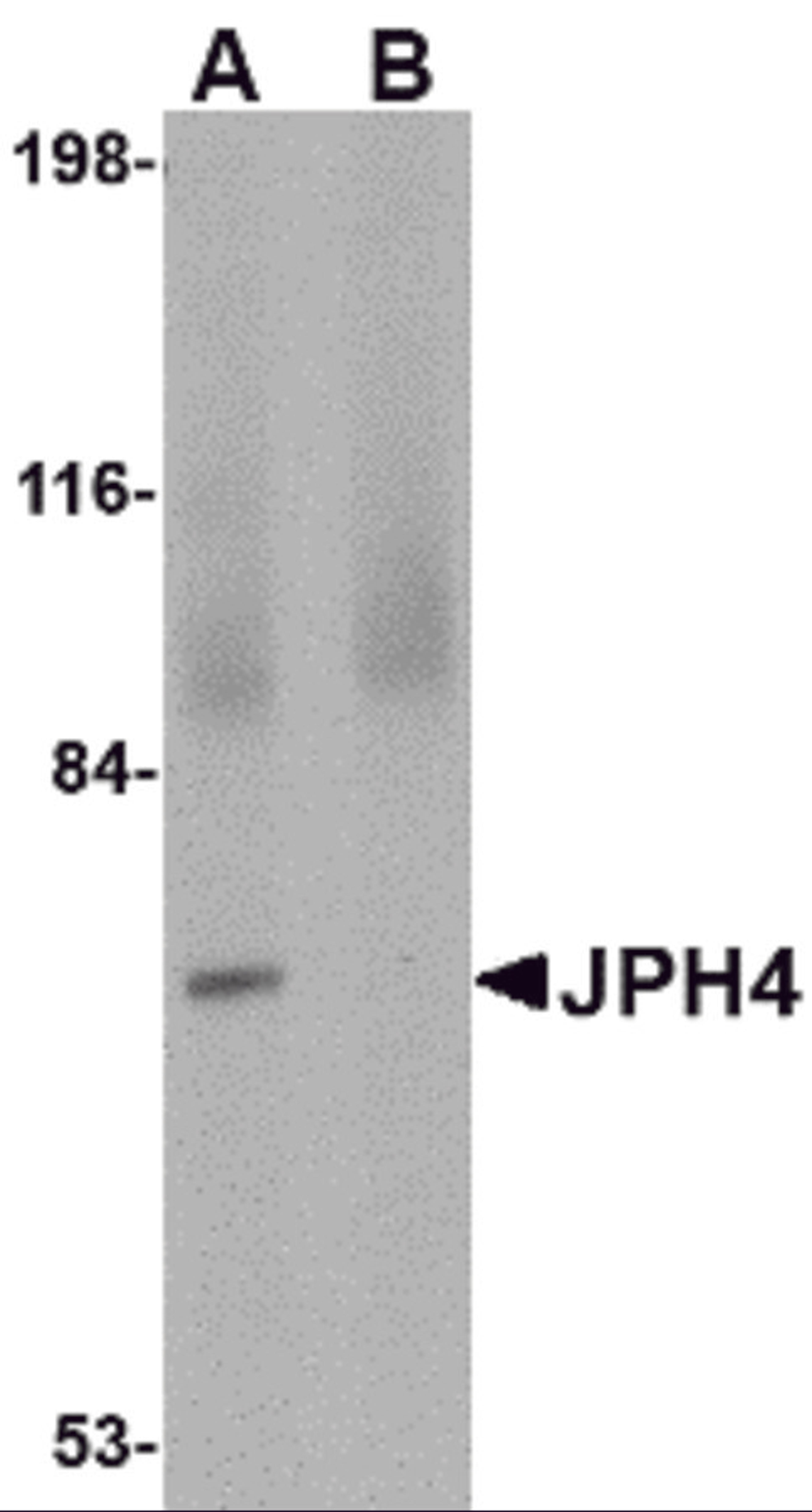Western blot analysis of JPH4 in 293 cell lysate with JPH4 antibody at 1 μg/mL in (A) the absence and (B) the presence of blocking peptide.