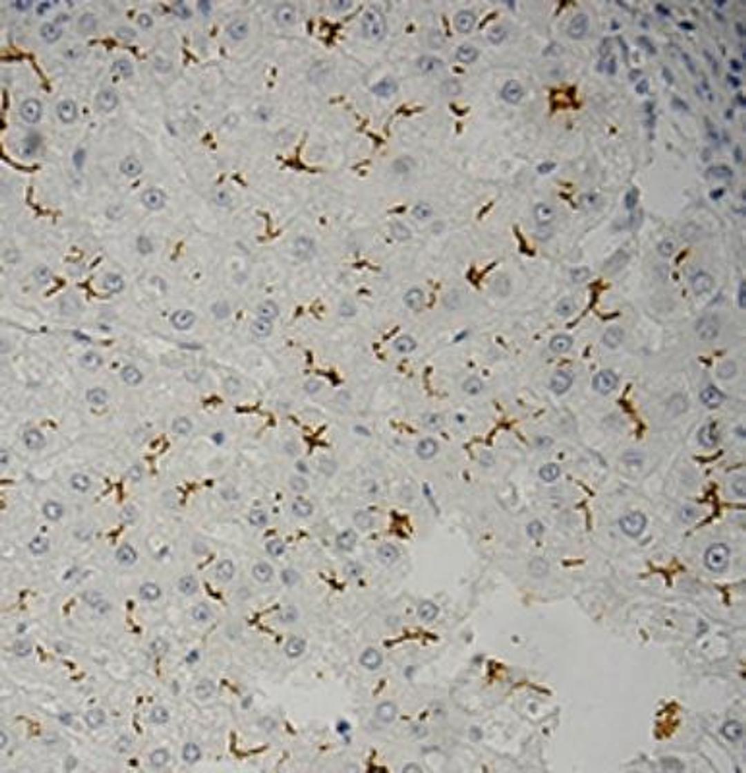 Immunohistochemistry-Paraffin: MDR1/ABCB1 Antibody (C219) [NB600-1036] - Staining of  formalin fixed paraffin embedded human liver tissue.