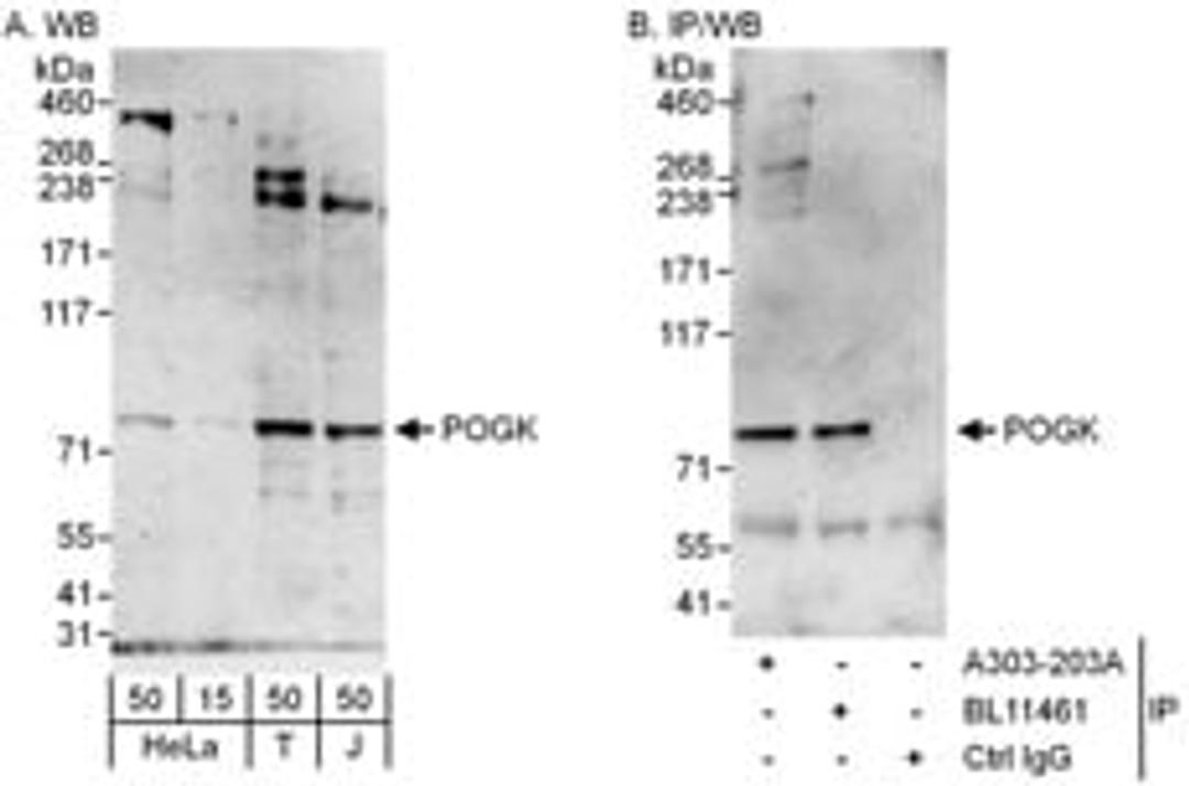 Detection of human POGK by western blot and immunoprecipitation.