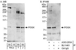 Detection of human POGK by western blot and immunoprecipitation.