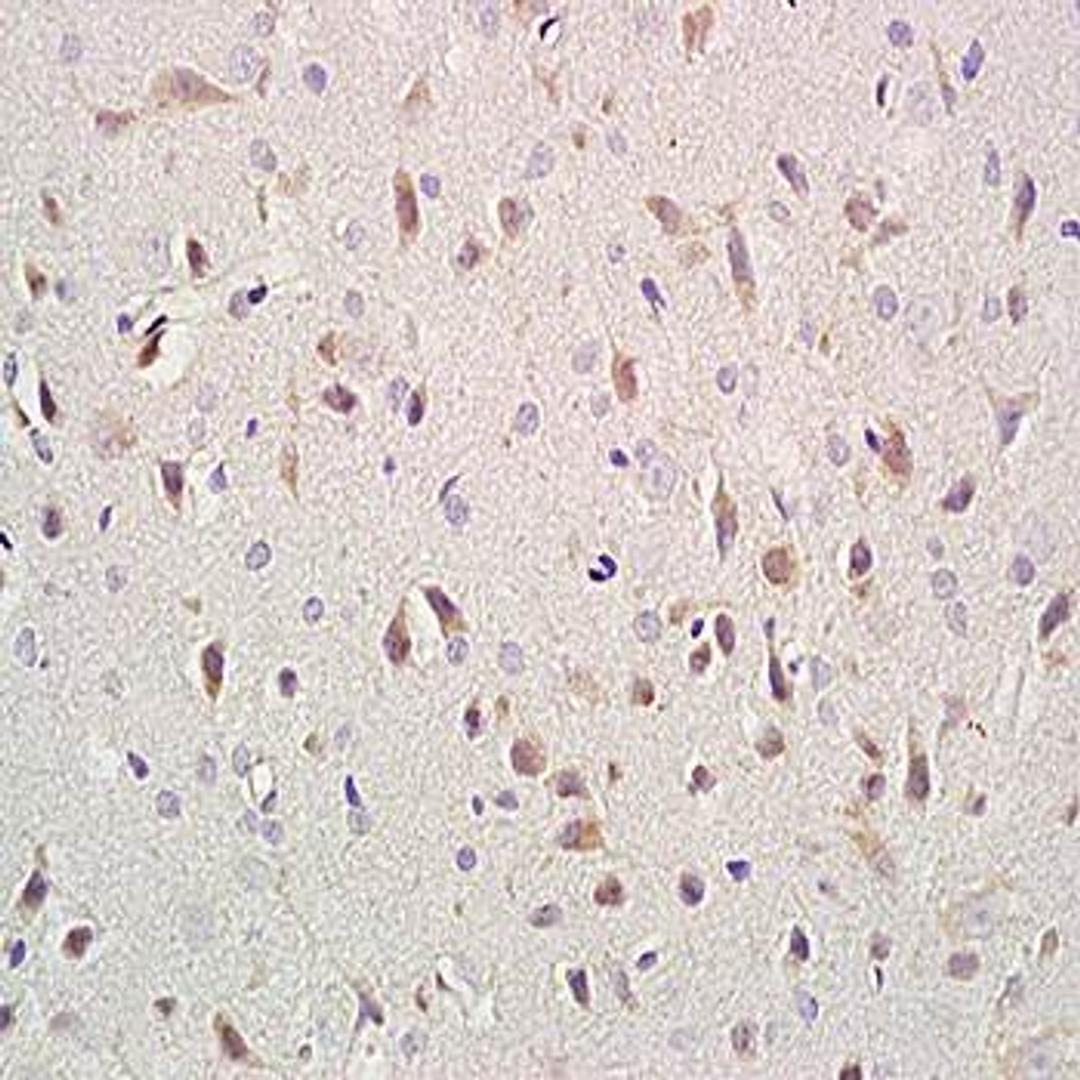 Immunohistochemical analysis of formalin-fixed and paraffin embedded rat brain tissue (Dilution at:1:400) using NCAM-L1 antibody