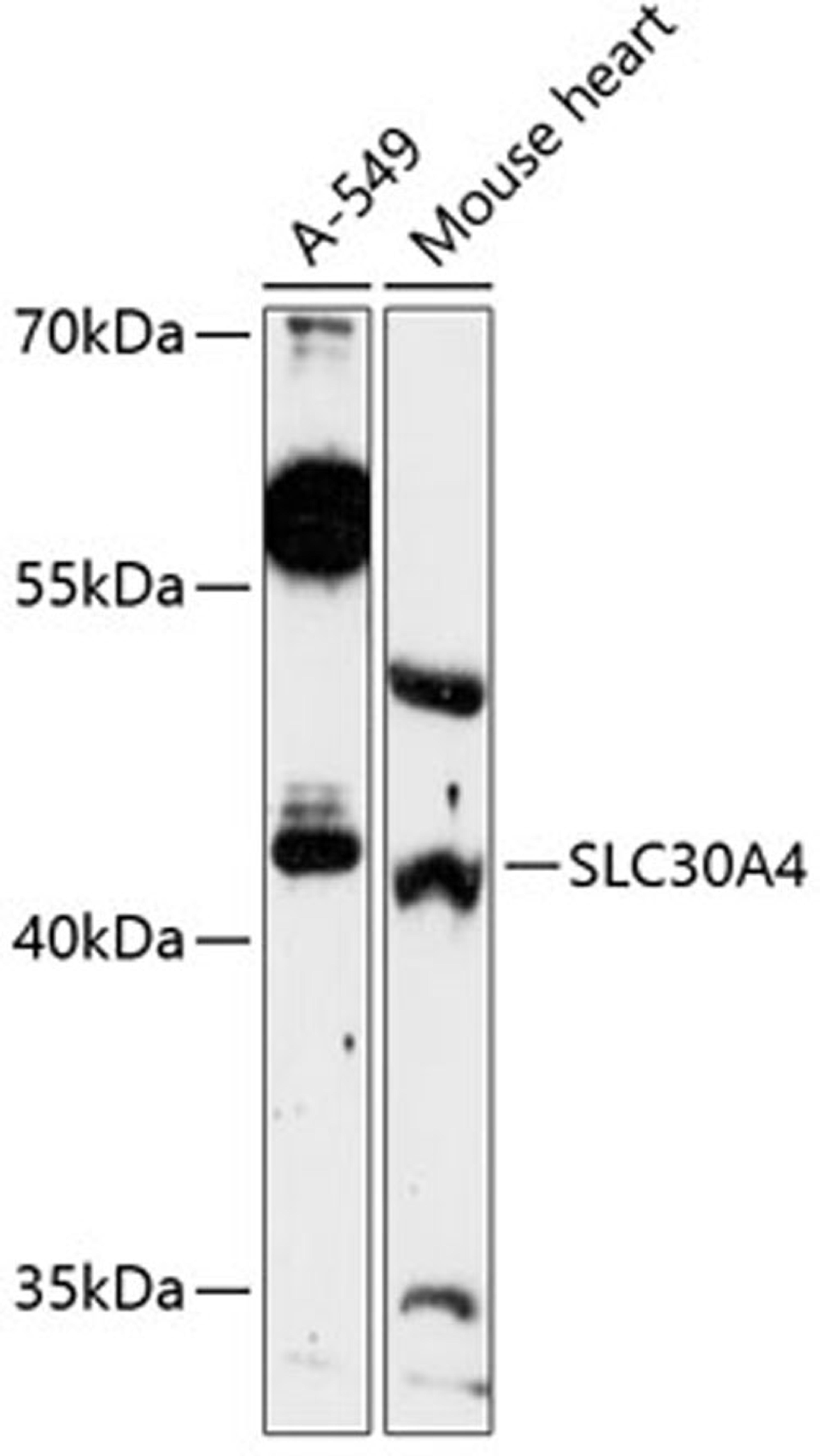 Western blot - SLC30A4 Antibody (A13053)