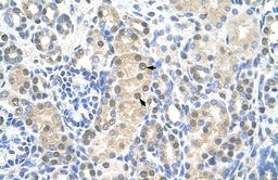 Antibody used in IHC on Human kidney.