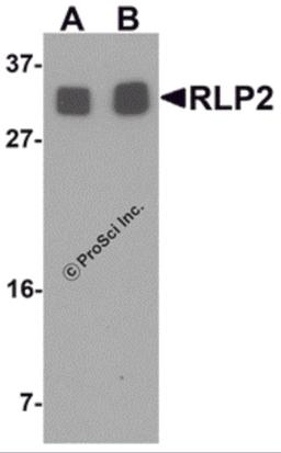 Western blot analysis of RLP2 in A549 cell lysate with RLP2 antibody at (A) 1 and (B) 2 &#956;g/mL.