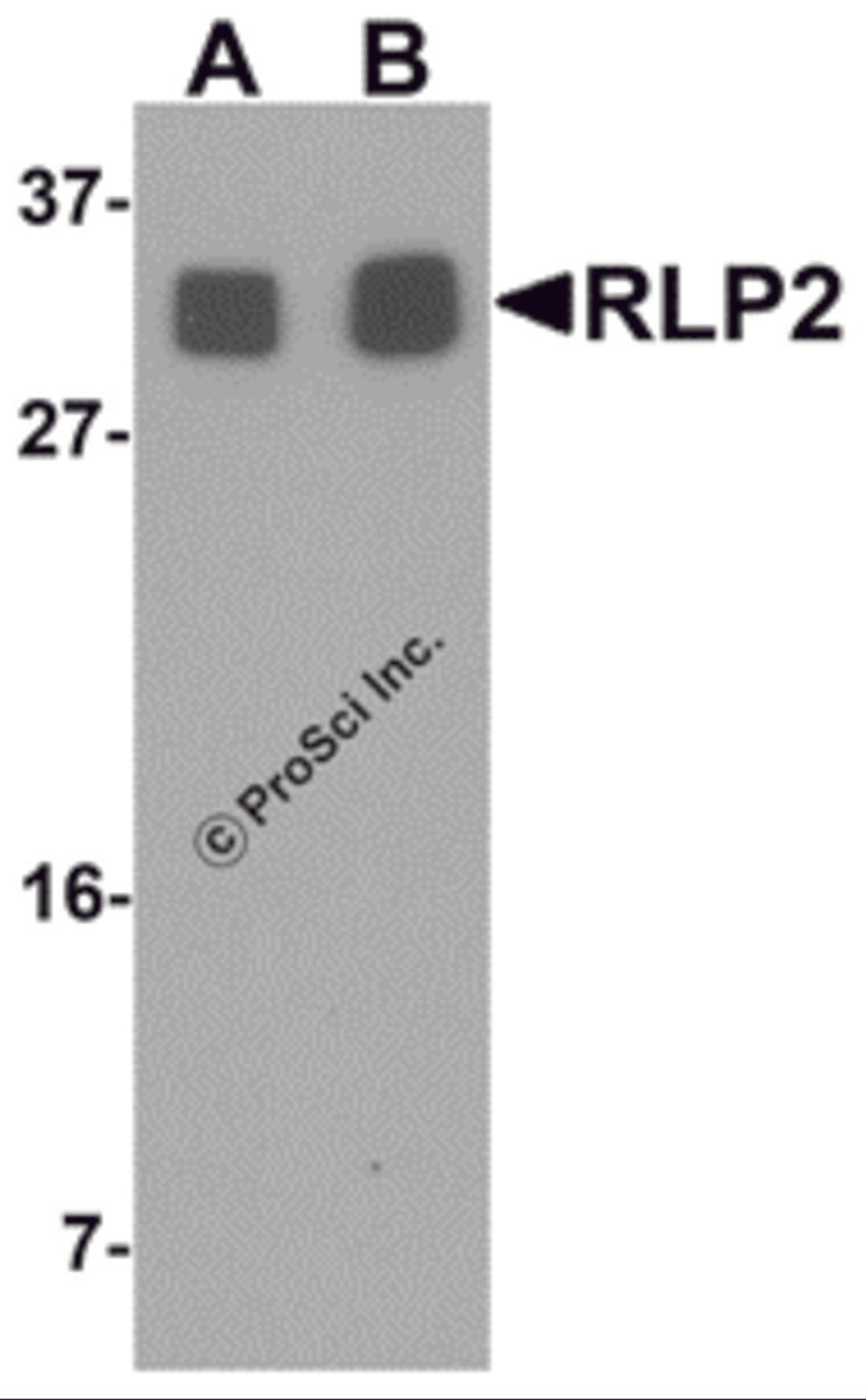 Western blot analysis of RLP2 in A549 cell lysate with RLP2 antibody at (A) 1 and (B) 2 μg/mL.