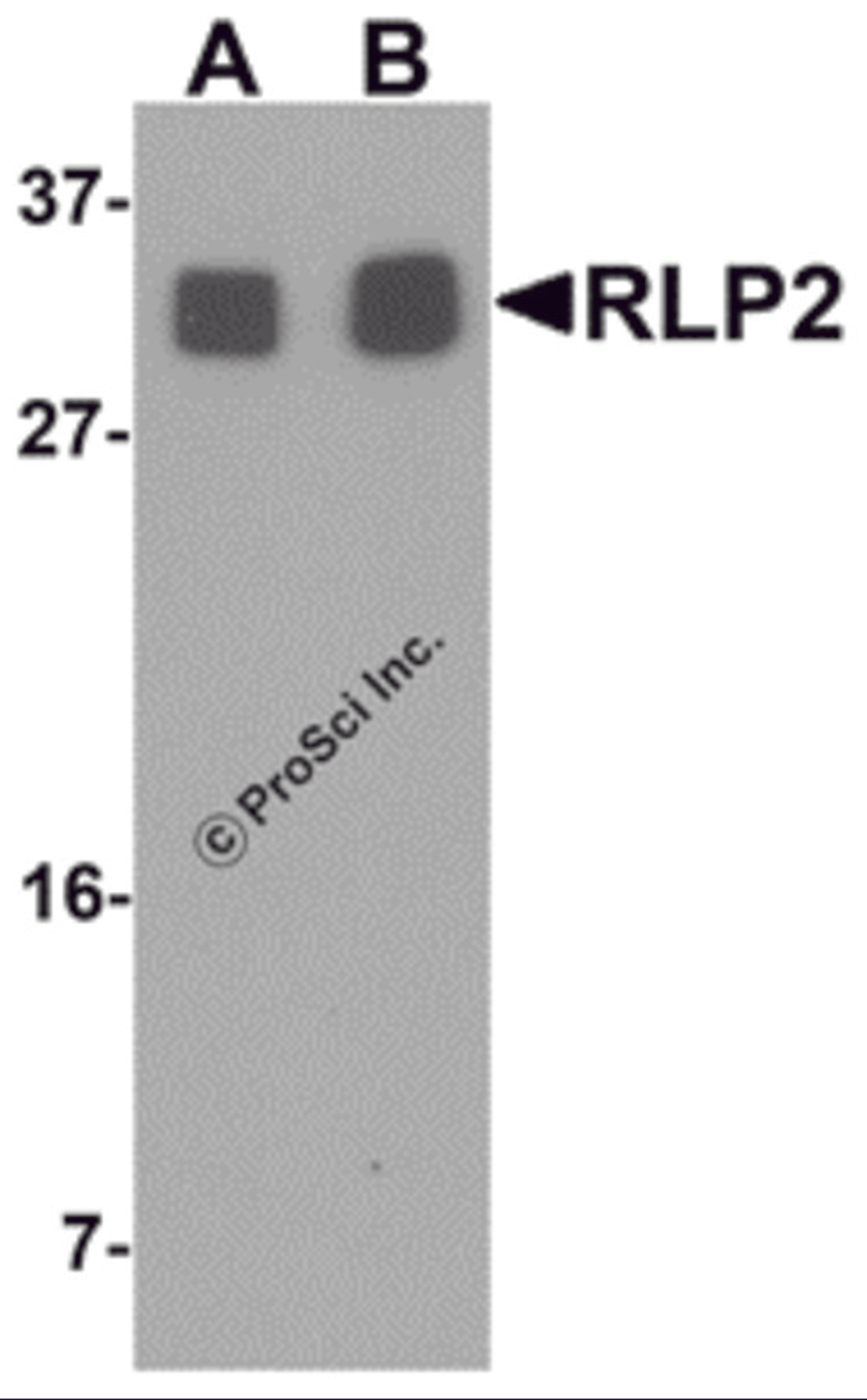 Western blot analysis of RLP2 in A549 cell lysate with RLP2 antibody at (A) 1 and (B) 2 μg/mL.