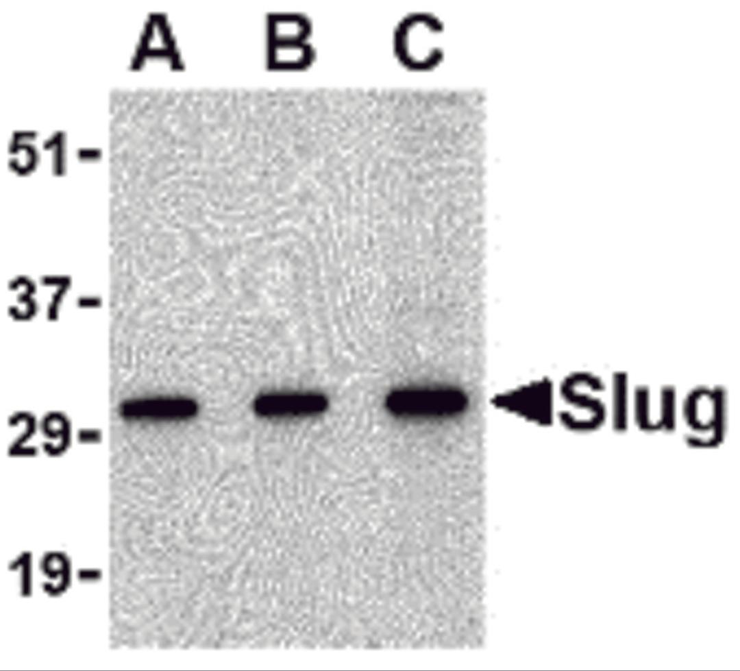 Western blot analysis of Slug in 293 cell lysate with Slug antibody at in (A) 0.5, (B) 1 and (C) 2 &#956;g/mL.