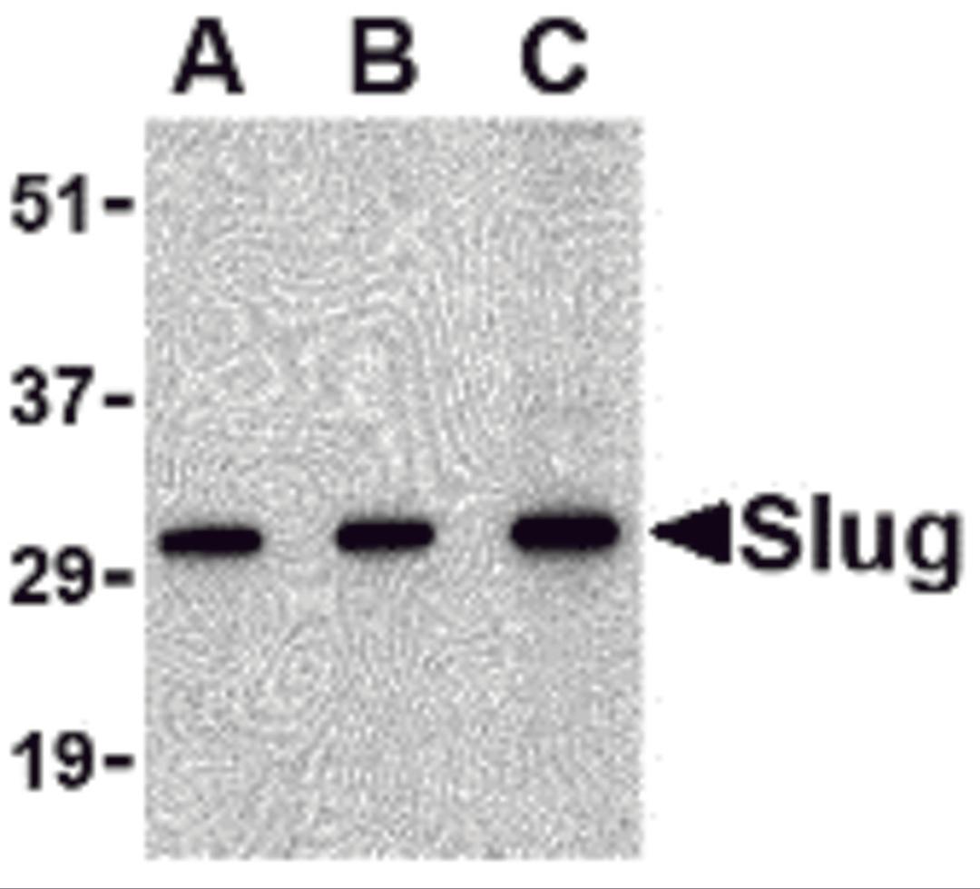 Western blot analysis of Slug in 293 cell lysate with Slug antibody at in (A) 0.5, (B) 1 and (C) 2 μg/mL.