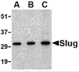 Western blot analysis of Slug in 293 cell lysate with Slug antibody at in (A) 0.5, (B) 1 and (C) 2 μg/mL.